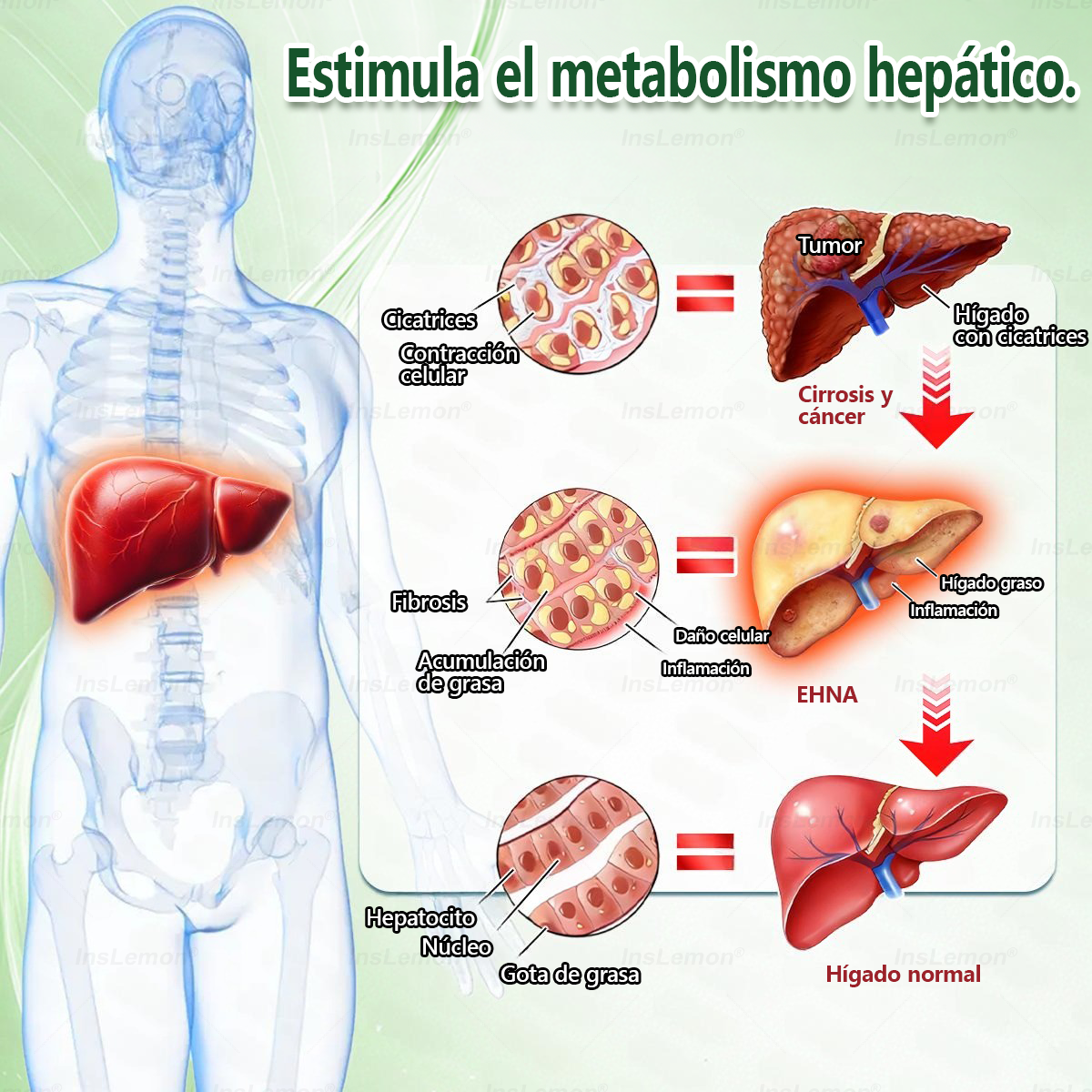 𝐈𝐧𝐬𝐋𝐞𝐦𝐨𝐧® 𝗠𝗼𝗿𝗶𝗻𝗴𝗮 × 𝗕𝗲𝗿𝗯𝗲𝗿𝗶𝗻𝗮 × 𝗔𝗠𝗣𝗞 𝟭𝟬-𝗶𝗻-𝟭 𝗣𝗮𝗿𝗰𝗵𝗲 𝗠𝗲𝘁𝗮𝗯𝗼𝗹𝗶𝗰𝗼 𝗱𝗲 𝗡𝗮𝗻𝗼 𝗠𝗶𝗰𝗿𝗼𝗮𝗴𝗵𝗮 (🇪🇸 Solo una vez al día, cambios visibles en 7 días) ✅ Para sobrepeso, diabetes, apnea del sueño, problemas articulares y más.
